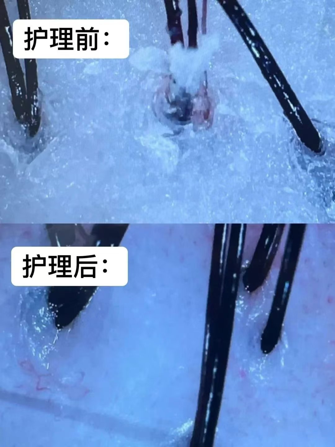 排毒传奇，让大爷的神奇之旅
