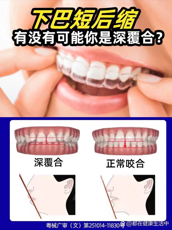 走一步故意深深地撞咬合走一步，故意深深地撞咬合-第2张图片
